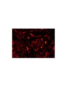 _ Accessori per strumenti a cordaMascherina gg-s 20x25 tartarugata